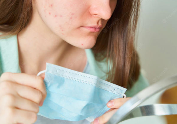 Face-masks