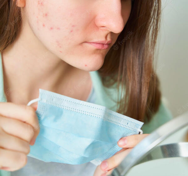 Face-masks